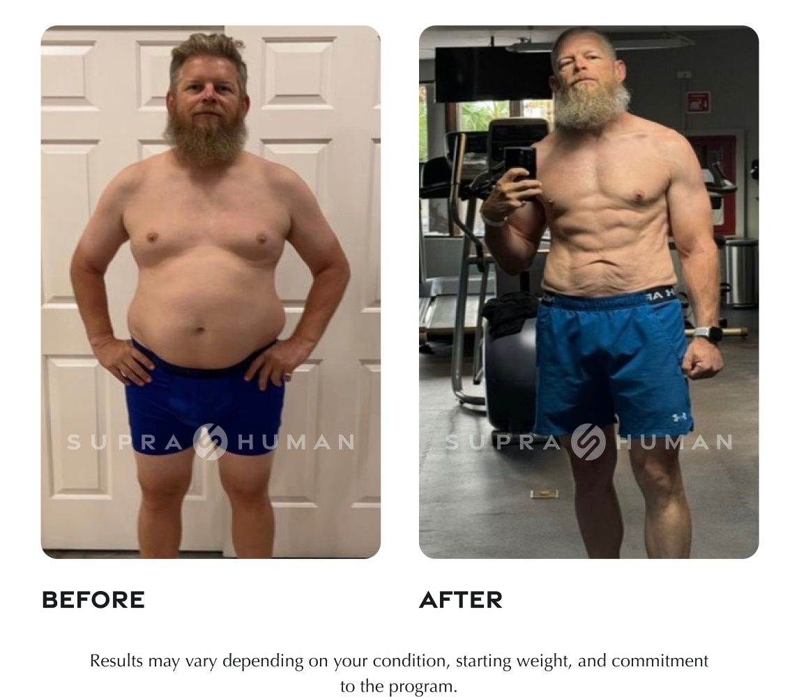 Supra-Human-Before-and-Afters-Light-45